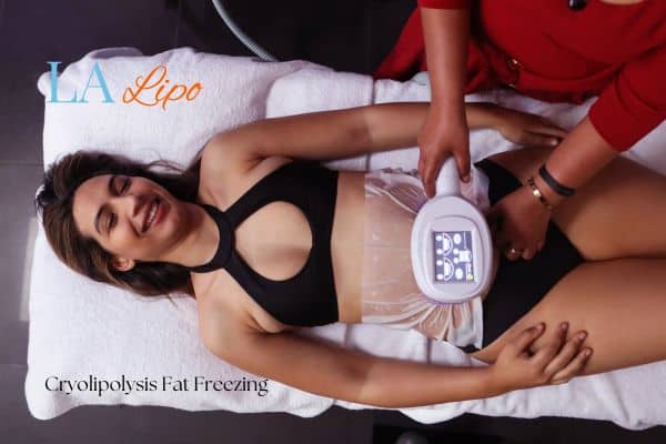 woman getting cryolipolysis Bishop's Stortford