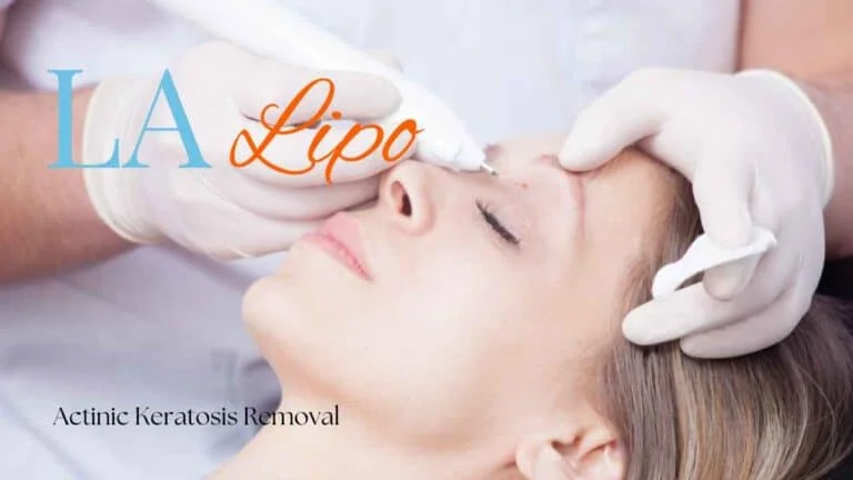 Woman receiving Actinic Keratosis Removal Treatment Bishop's Stortford