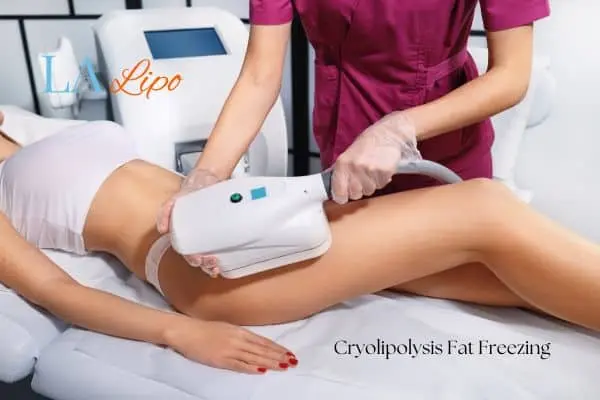 Woman receiving coolsculpting Bishop's Stortford treatment on her thighs