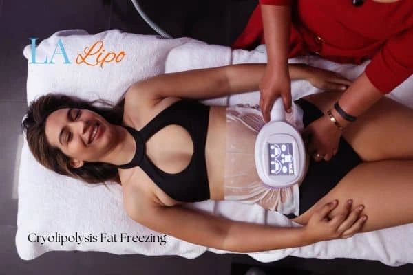woman getting cryolipolysis Bishop's Stortford