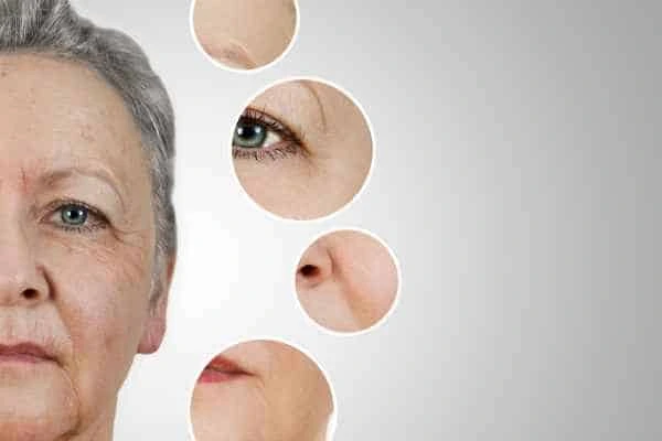 HIFU Facelift Bishop's Stortford from LA LIPO