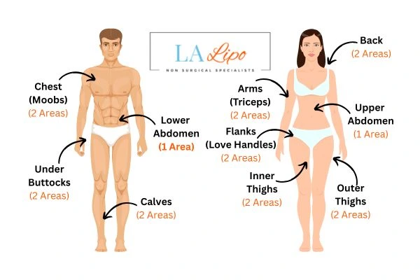 LA LIPO Cryolipolysis Areas Bishop's Stortford
