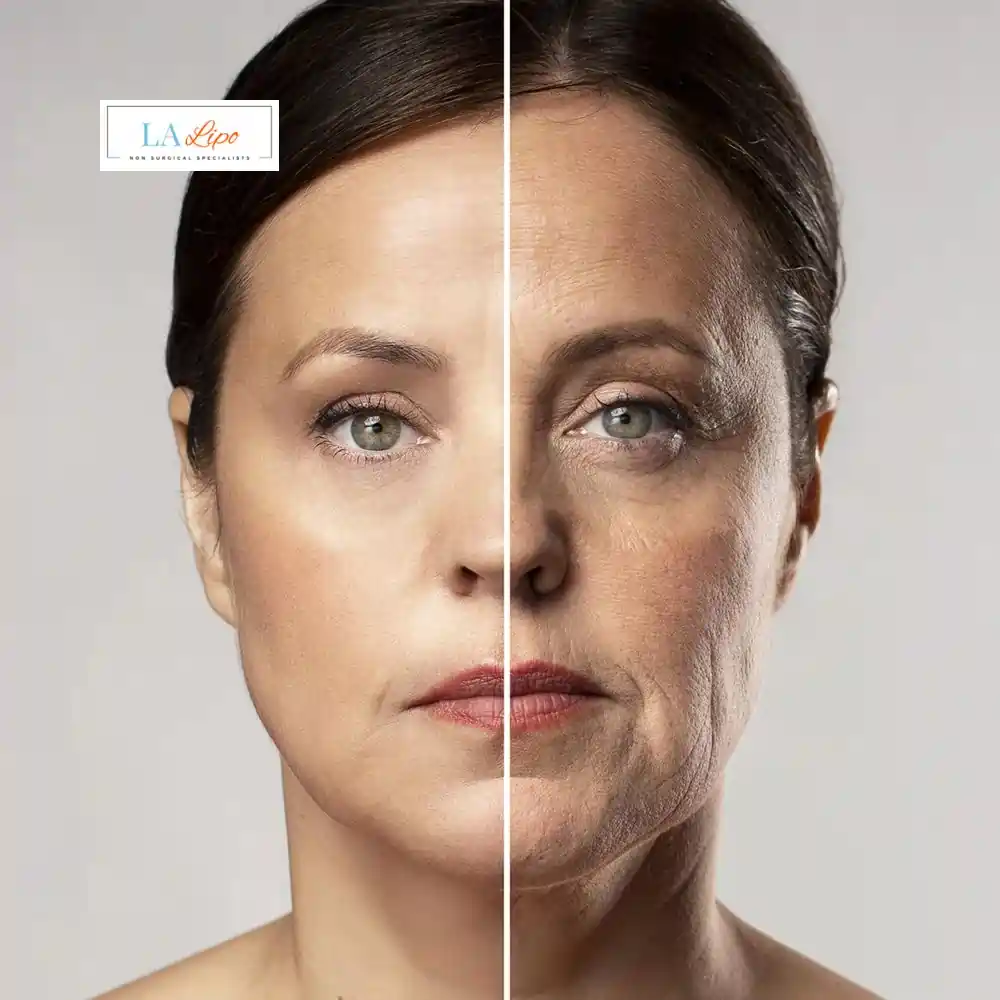 How Can You Tell If Non-Surgical Skin Tightening Is Right for You Bishop's Stortford?