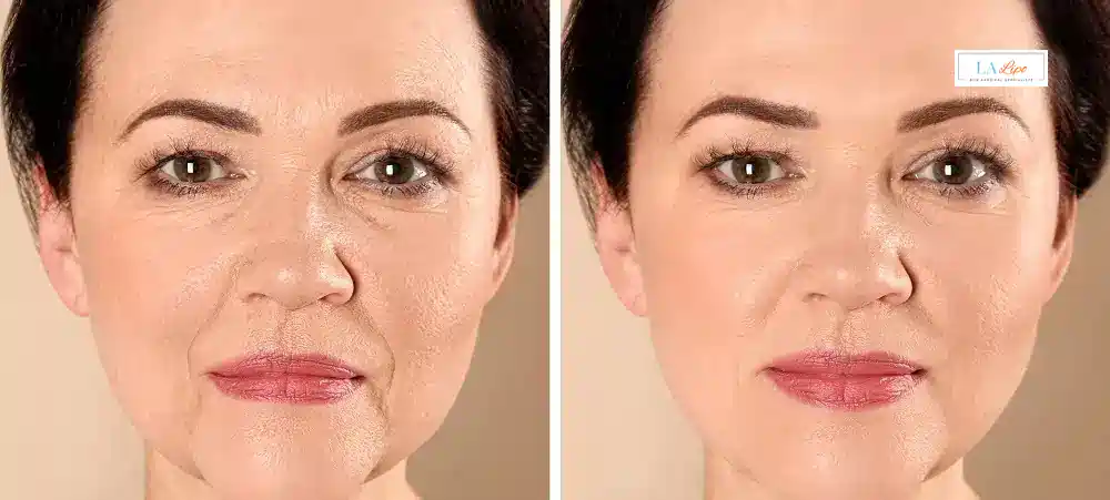 How Long Does It Take to See Results and How Long Do They Last Bishop's Stortford?