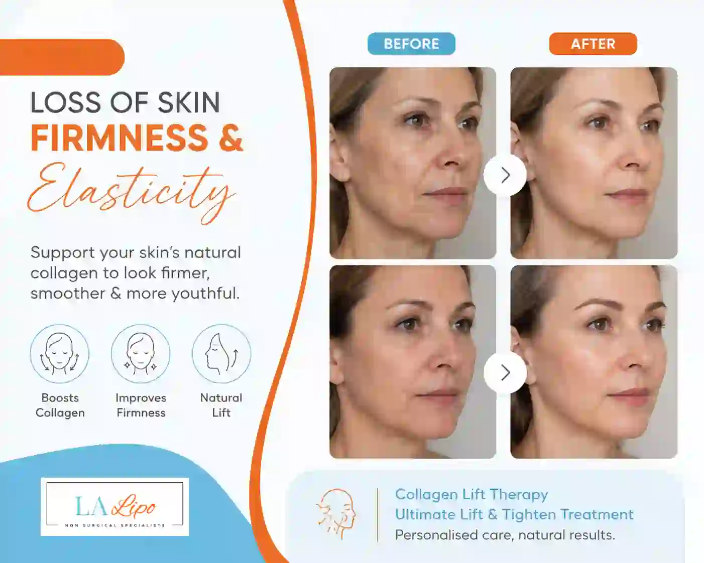 Sign #7: Loss of Skin Firmness and Elasticity Bishop's Stortford