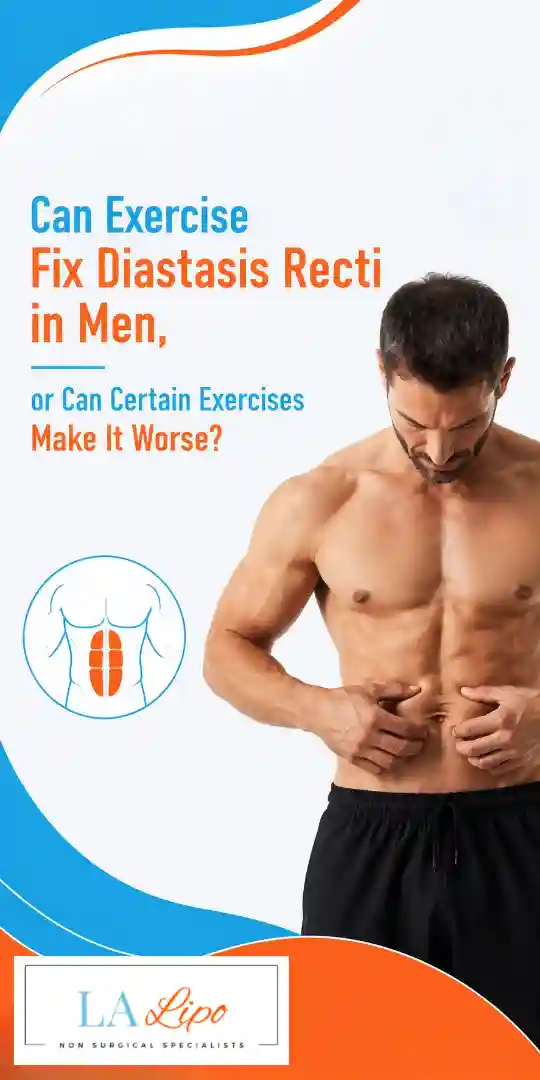 Can Exercise Fix Diastasis Recti in Men, or Can Certain Exercises Make It Worse Bishop's Stortford?