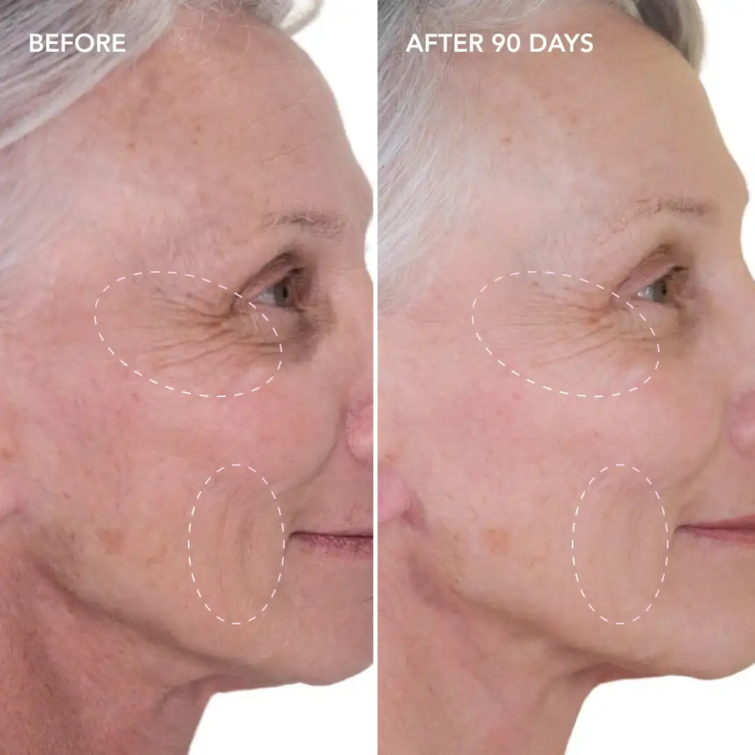 When will you see results Bishop's Stortford
